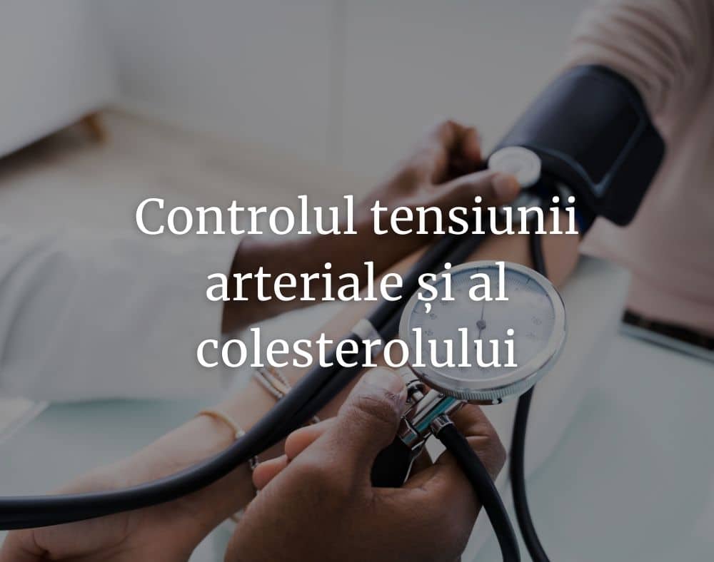 Control tensiune